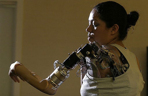 rimworld how to make bionic limbs